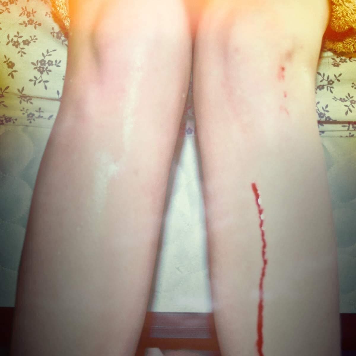 Romance Is Boring [10th Anniversary] [Gold 2 LP] por Los Campesinos! — capa do álbum