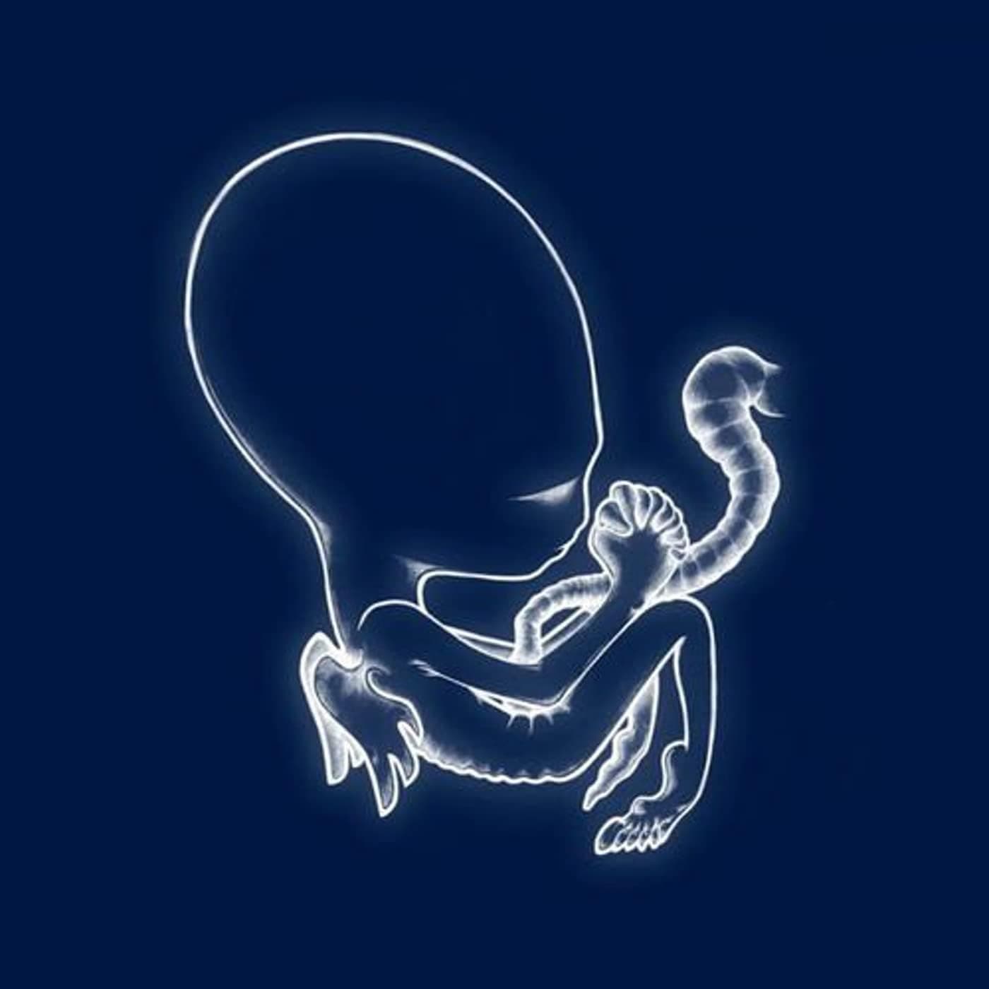 Agaetis Byrjun [Disco de Vinil] por Sigur Rós — capa do álbum