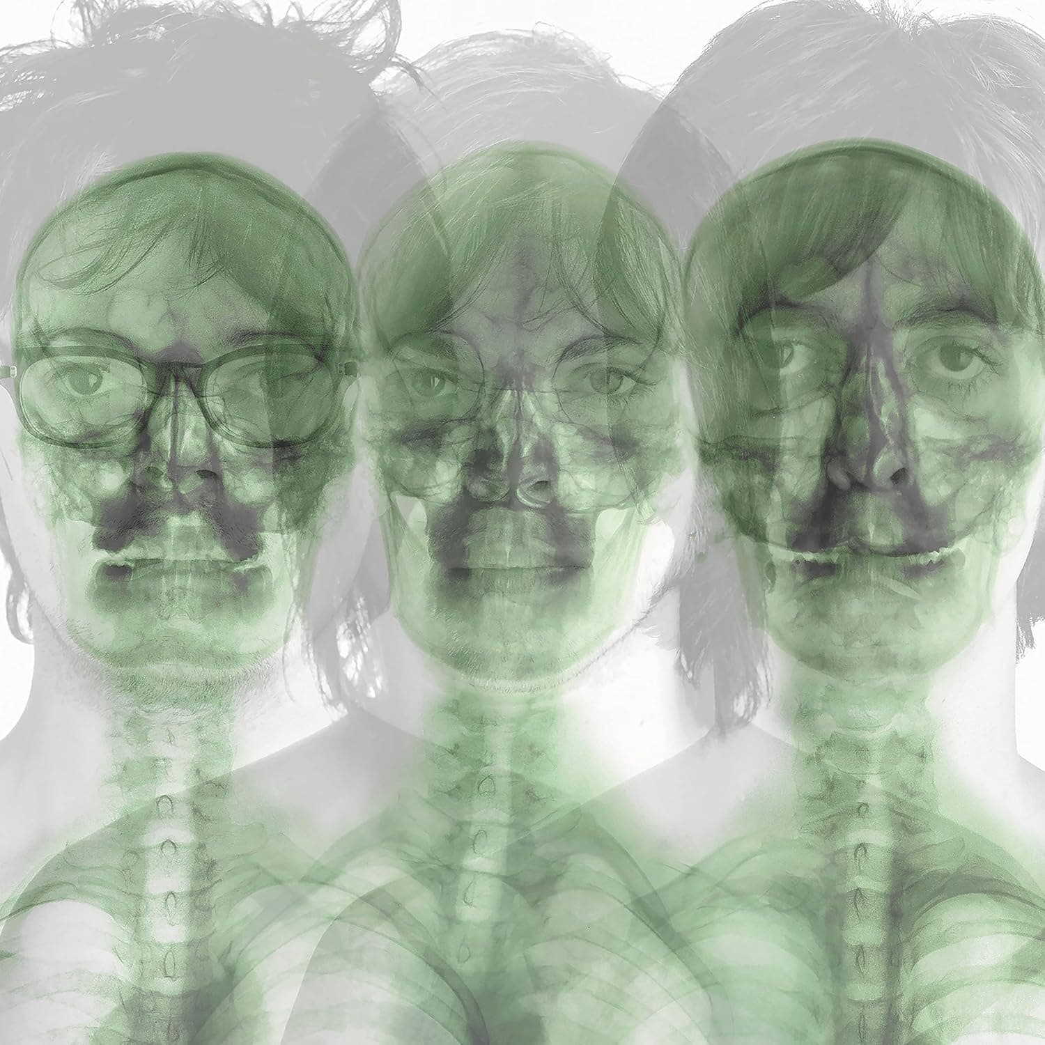 SUPERGRASS (NEON ORANGE VINYL) por Supergrass — capa do álbum